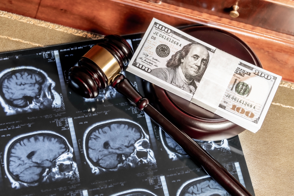 filing a catastrophic injury in New Jersey