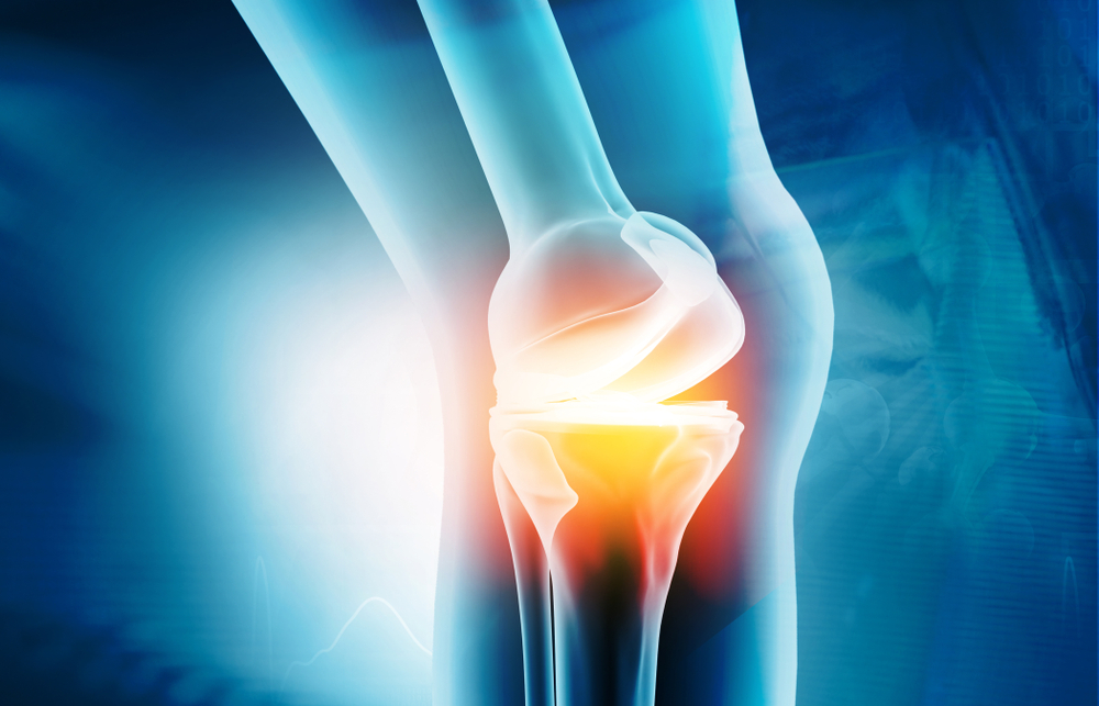 Workers Comp Claims for a Work-Related Meniscus Injury